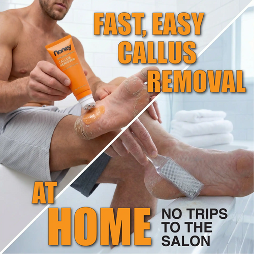 Professional Strength Callus Remover Kit