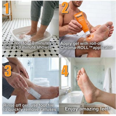 Professional Strength Callus Remover Kit