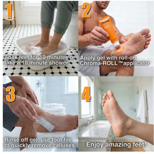 Professional Strength Callus Remover Kit