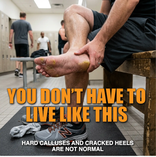 Professional Strength Callus Remover Kit